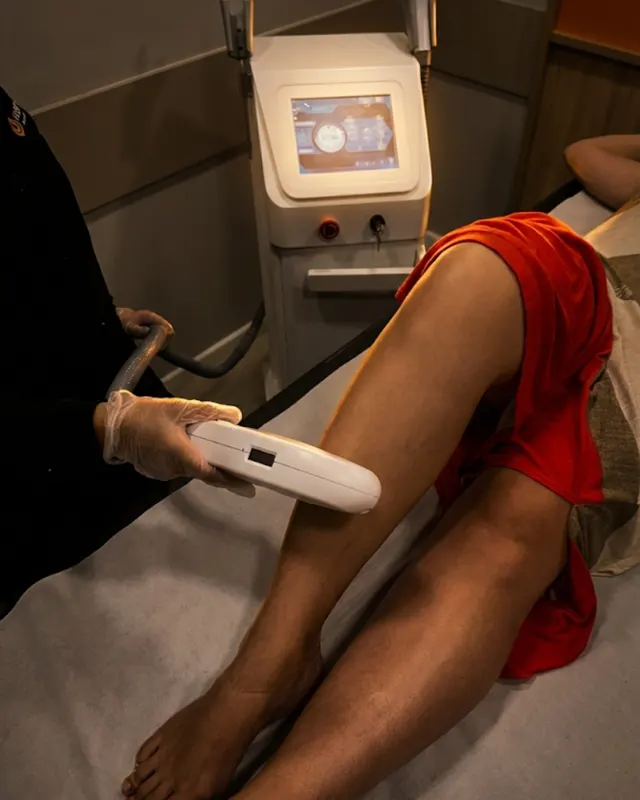 Sessão de depilação a laser na Realser Londrina